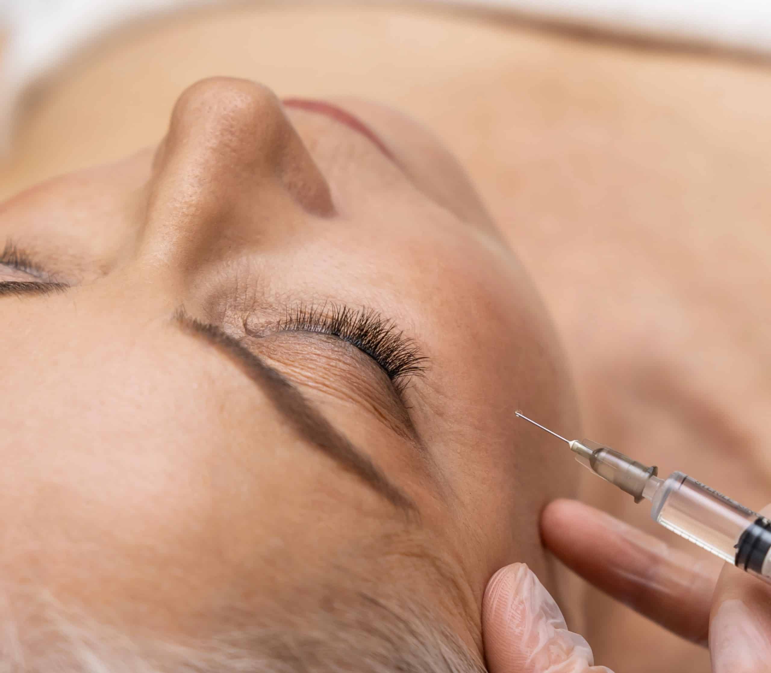 Bio stimulation à Paris | IATROS