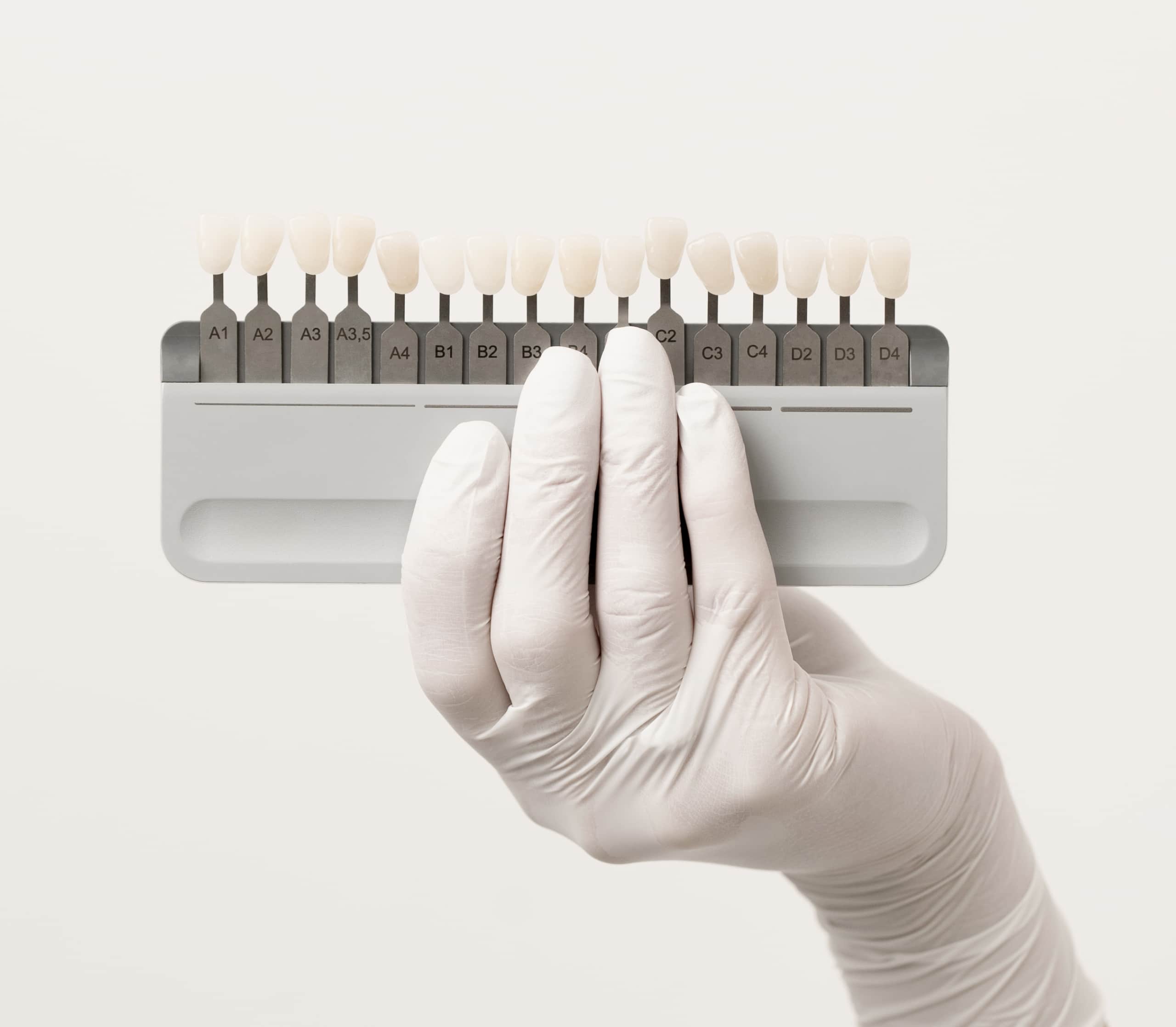 Formation facettes dentaries Paris